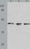 Casein Kinase 2 Alpha 1 antibody, TA323094, Origene, Western Blot image 