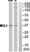 Cytokine receptor-like factor 1 antibody, orb314393, Biorbyt, Western Blot image 