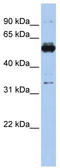 Phosphoglycerate Dehydrogenase antibody, TA334410, Origene, Western Blot image 