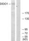Death Inducer-Obliterator 1 antibody, LS-C119545, Lifespan Biosciences, Western Blot image 