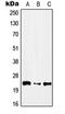 Interferon Alpha 13 antibody, orb215609, Biorbyt, Western Blot image 