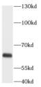 Angiopoietin Like 2 antibody, FNab00397, FineTest, Western Blot image 