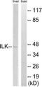 Integrin-linked protein kinase antibody, TA312157, Origene, Western Blot image 