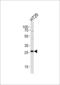 Nicotinamide N-Methyltransferase antibody, LS-C162921, Lifespan Biosciences, Western Blot image 