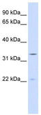 Indolethylamine N-Methyltransferase antibody, TA346861, Origene, Western Blot image 