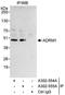 Proteasomal ubiquitin receptor ADRM1 antibody, A302-554A, Bethyl Labs, Immunoprecipitation image 