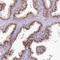 Von Willebrand Factor A Domain Containing 5A antibody, HPA037814, Atlas Antibodies, Immunohistochemistry paraffin image 