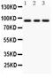 Protein Kinase C Epsilon antibody, PA5-79869, Invitrogen Antibodies, Western Blot image 