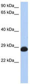 Ras-related protein Rab-39B antibody, TA337808, Origene, Western Blot image 