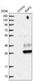 Epithelial Membrane Protein 2 antibody, NBP1-86847, Novus Biologicals, Western Blot image 