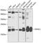 Dynein light chain 1, axonemal antibody, GTX66007, GeneTex, Western Blot image 