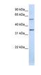 Tight Junction Associated Protein 1 antibody, NBP1-53200, Novus Biologicals, Western Blot image 