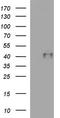 Chitobiase antibody, TA590635, Origene, Western Blot image 