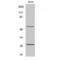 CD69 Molecule antibody, LS-C382559, Lifespan Biosciences, Western Blot image 