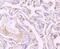 Nuclear Receptor Coactivator 1 antibody, A00856, Boster Biological Technology, Immunohistochemistry paraffin image 