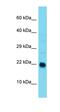 ADP Ribosylation Factor Like GTPase 9 antibody, orb326440, Biorbyt, Western Blot image 