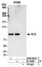 HLCS antibody, A304-261A, Bethyl Labs, Immunoprecipitation image 