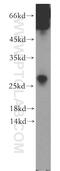 SSX Family Member 5 antibody, 12401-1-AP, Proteintech Group, Western Blot image 