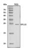 60S ribosomal protein L10 antibody, A04190-3, Boster Biological Technology, Western Blot image 