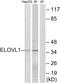ELOVL Fatty Acid Elongase 1 antibody, PA5-39159, Invitrogen Antibodies, Western Blot image 