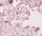 Angiopoietin 2 antibody, A52448-100, Epigentek, Immunohistochemistry paraffin image 