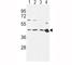 C-C Motif Chemokine Receptor 7 antibody, F48967-0.4ML, NSJ Bioreagents, Western Blot image 