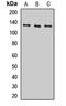 Protein hairless antibody, LS-C669001, Lifespan Biosciences, Western Blot image 