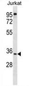 UBX Domain Protein 8 antibody, AP54451PU-N, Origene, Western Blot image 