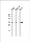 Phosphatidylinositol N-acetylglucosaminyltransferase subunit C antibody, PA5-72316, Invitrogen Antibodies, Western Blot image 