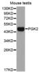 Phosphoglycerate kinase 2 antibody, LS-C332985, Lifespan Biosciences, Western Blot image 
