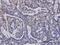 Ubiquitin Conjugating Enzyme E2 D1 antibody, H00007321-M01, Novus Biologicals, Immunohistochemistry frozen image 