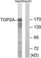 DNA topoisomerase 2-alpha antibody, TA313198, Origene, Western Blot image 