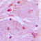 Cysteine and glycine-rich protein 1 antibody, LS-C352063, Lifespan Biosciences, Immunohistochemistry frozen image 