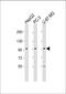 Protocadherin-10 antibody, 61-167, ProSci, Western Blot image 