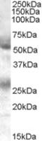 Feline Leukemia Virus Subgroup C Cellular Receptor 1 antibody, LS-C54846, Lifespan Biosciences, Western Blot image 
