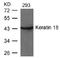 Keratin 18 antibody, AP02789PU-N, Origene, Western Blot image 