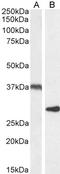 Uncoupling Protein 2 antibody, TA302628, Origene, Western Blot image 