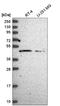 Harbinger Transposase Derived 1 antibody, NBP2-55680, Novus Biologicals, Western Blot image 