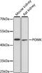 Protein O-Mannose Kinase antibody, A15529, ABclonal Technology, Western Blot image 