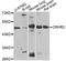 Corticotropin Releasing Hormone Receptor 2 antibody, LS-C747532, Lifespan Biosciences, Western Blot image 
