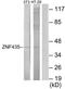 Zinc Finger And SCAN Domain Containing 16 antibody, TA315831, Origene, Western Blot image 