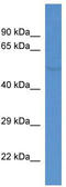 Fukutin Related Protein antibody, TA335472, Origene, Western Blot image 