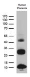 Translocase Of Inner Mitochondrial Membrane 29 antibody, M31934, Boster Biological Technology, Western Blot image 