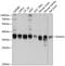 Dimethylarginine Dimethylaminohydrolase 1 antibody, 13-563, ProSci, Western Blot image 