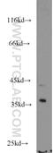 NECAP Endocytosis Associated 2 antibody, 15899-1-AP, Proteintech Group, Western Blot image 