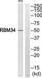 RNA Binding Motif Protein 34 antibody, TA315214, Origene, Western Blot image 