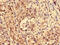 LIM Domain Binding 1 antibody, CSB-PA771433LA01HU, Cusabio, Immunohistochemistry paraffin image 