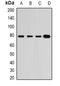 RAS Guanyl Releasing Protein 3 antibody, abx142188, Abbexa, Western Blot image 