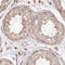 HAL antibody, HPA038547, Atlas Antibodies, Immunohistochemistry frozen image 