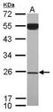 YEATS Domain Containing 4 antibody, GTX118115, GeneTex, Western Blot image 